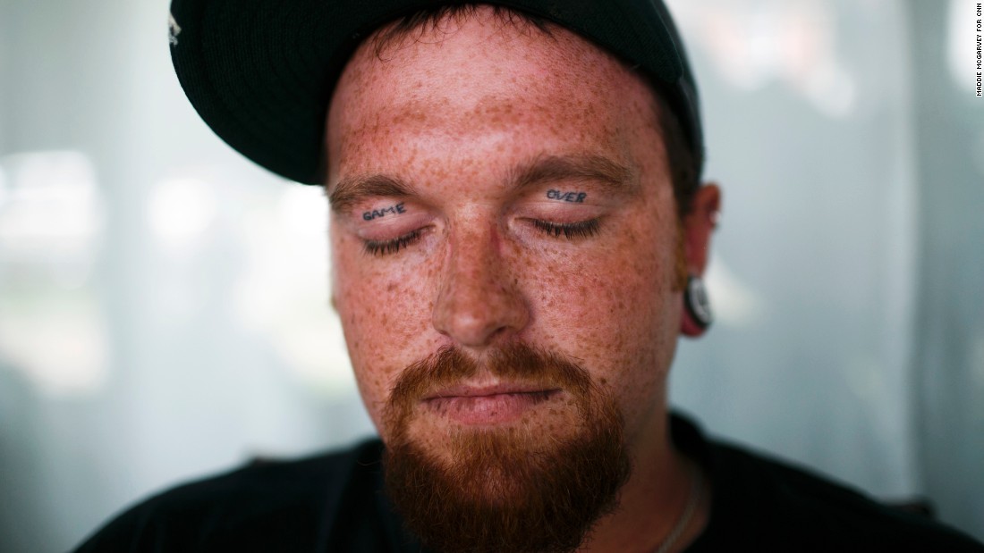 James Blevins, 28, has &quot;Game Over&quot; tattooed on his eyelids. Blevins has been sober for four months and lives in one of The Lifehouse recovery homes in Huntington.
