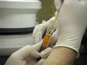  The serum is suctioned from the tiger tube and placed into a smaller sample tube.