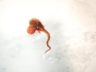 This baby skate has a yolk sack still attached to it. The baby uses the yolk as food while it grows. Usually this happens in the skate case. I wonder what happened with this little guy.