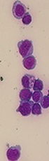 The Janus-faced Nature of miR-22 in Hematopoiesis: Is It an Oncogenic Tumor Suppressor or Rather a Tumor-Suppressive Oncogene?