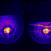 Dynamic x-ray image of void collapse in shocked explosive. The void (bright spot in the center) collapses as the shock wave passes through it.