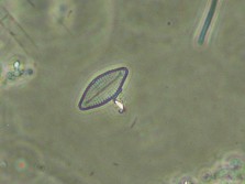 Various Diatom species collected