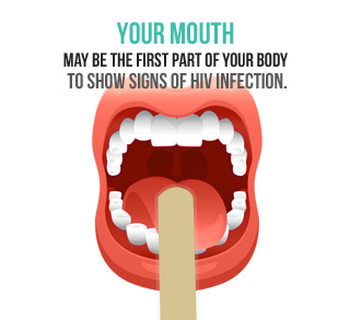 Your mouth may be the first part of your body to show signs of the HIV infection.