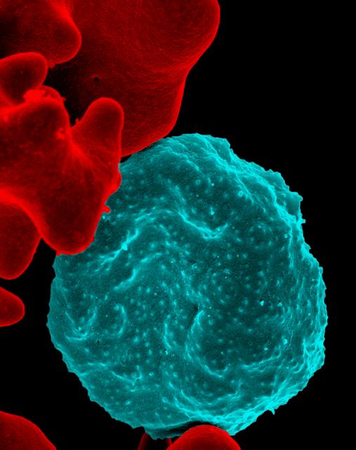 Image of malaria-infected red blood cell.