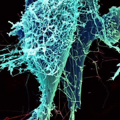 #Ebola is a severe, often deadly disease in people and animals such as monkeys and apes. The natural reservoir host of Ebola virus remains unknown. However, researchers believe that the virus is animal-borne and that bats are the most likely reservoir. People get Ebola through direct contact (through broken skin or mucous membranes) with blood or body fluids of a person who is sick with or died from Ebola, or with objects like needles, clothes or bedding contaminated with infected body fluids. The first Ebolavirus species was discovered in 1976 in what is now the Democratic Republic of the Congo near the Ebola River. Since then, outbreaks have appeared sporadically, including the 2014 outbreak in West Africa. Learn more about Ebola and CDC’s response to the 2014 outbreak: www.cdc.gov/ebola
Photo credit: CDC Public Health Image Library (phil.cdc.gov). #UndertheLens #biology #science #CDC #health #PublicHealth