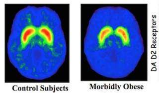 Image of brain scans of control and Obese subjects showing reduced DA D2 receptor activity from control