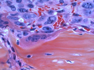 Sample image for NCI Cancer Close Up 2016