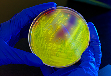 	The photo shows a culture plate of methicillin-resistant Staphylococcus aureus (MRSA), a type of bacteria that is resistant to several antibiotics. CDC provides gold standard laboratory methods and isolates that support development of new diagnostics for antibiotic resistance. CDC photo, James Gathany.