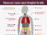 Read a blog post about the latest CDC Vital Signs on cancer and tobacco use.
