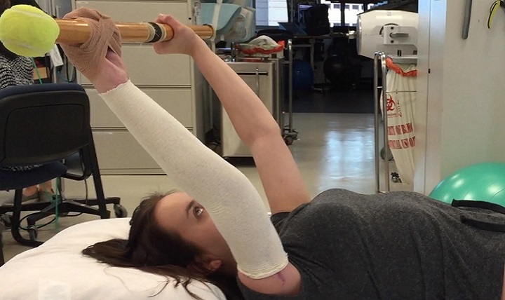 Kelsey Ward, a 22-year-old trauma patient, exercises her arm at the Center for the Intrepid as part of her daily rehabilitation after her arm was replanted by surgeons at Brooke Army Medical Center. (U.S. Army photo by Christopher Ebner)