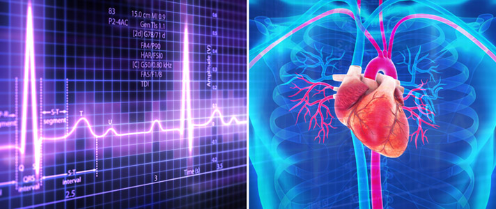 FDA-Approved Devices that Keep the Heart Beating - featured CU