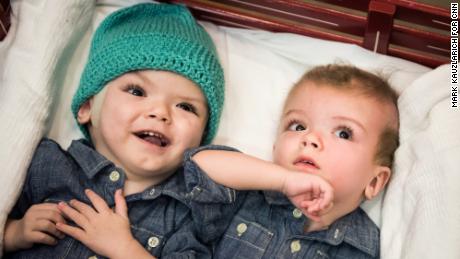 Anias (left) and Jadon McDonald lay in a red wagon at their goodbye party at Montefiore Children&#39;s Hospital in The Bronx, New York, N.Y. on December 13, 2016.

Credit: Mark Kauzlarich for CNN