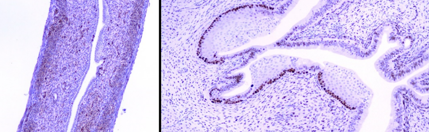 Histographs of rat endometrial tissue