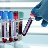 Technician placing blood tubes in laboratory centrifuge