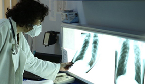 Image of a CDC Scientist looking at a TB lung through an X-Ray