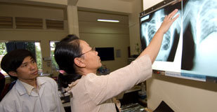 Woman compares two chest xrays on light board, man behind her observes