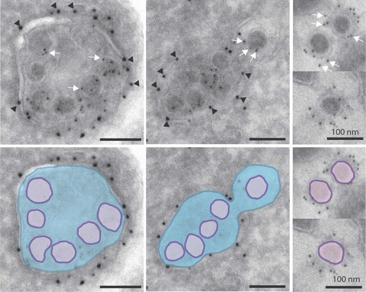 Coronaviruses inside lysosomes imaged by EM