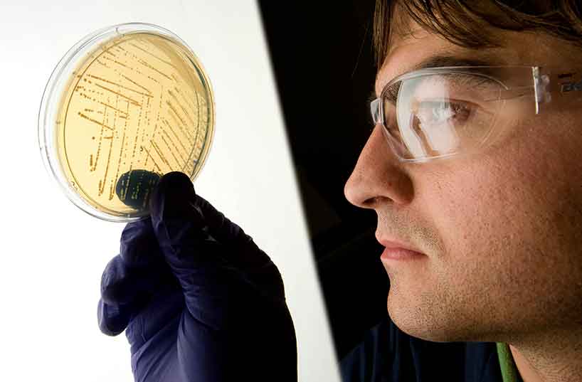 Scientist looking at an agar gel culture plate