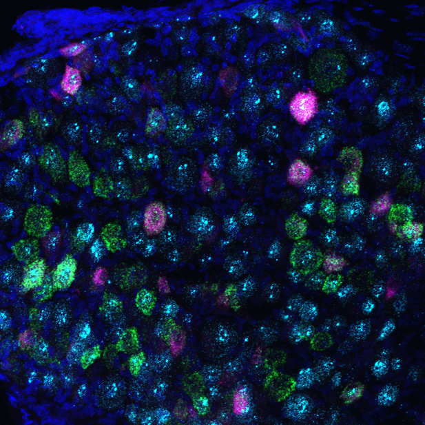 Image of a multicolor in situ hybridization showing sensory neurons that innervate the bladder (magenta) express the Piezo2 gene (green)