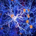 Microglia cell, shaded white in the foreground, with β-amyloid plagues in orange and other cellular structures shaded blue in the background.