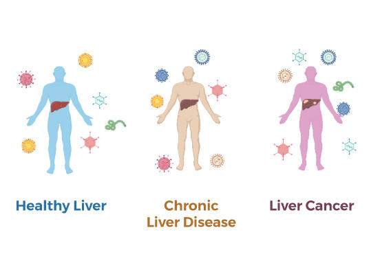 Virus particles surround three human figures with their livers highlighted. One figure has a healthy liver, one has chronic liver disease and one has liver cancer.