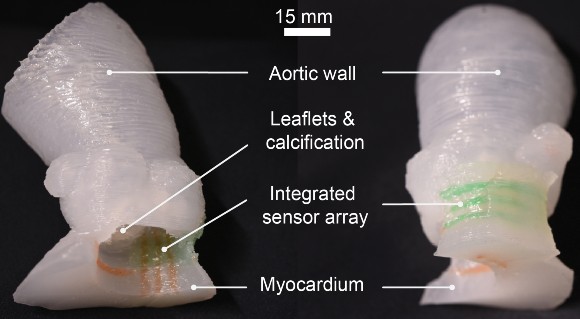 3D printed model of aorta from heart valve replacement patient