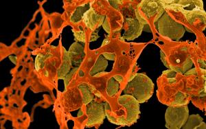 Image of Staphylococcus aureus a bacterium that causes frequent infections in people with STAT3 dominant-negative disease