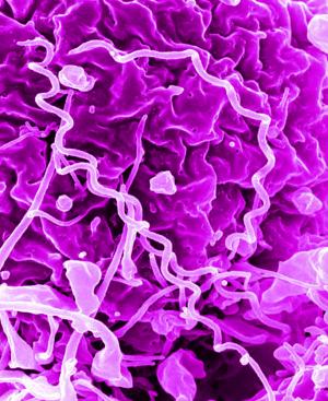 Image of syphilis bacteria