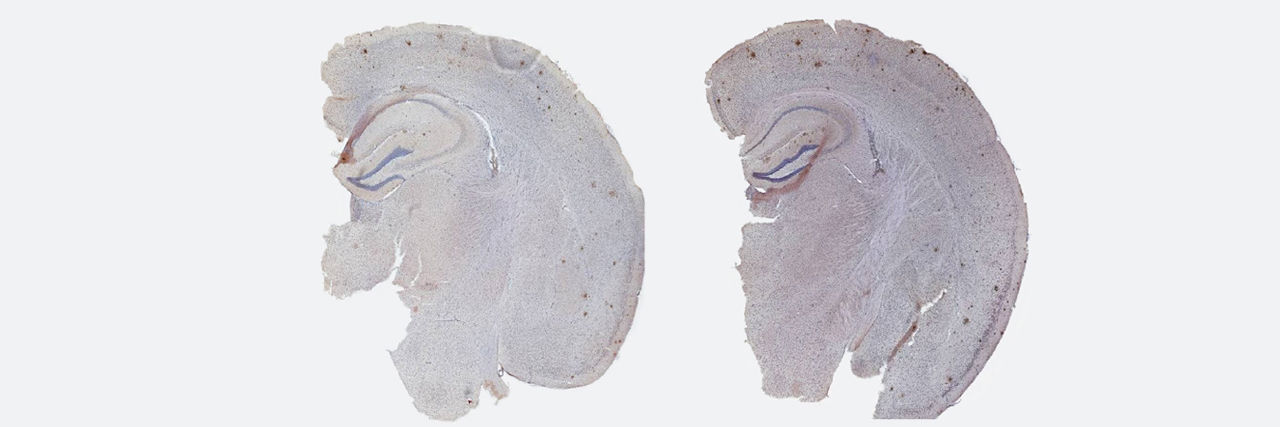 Two brain slices from male and female mice.