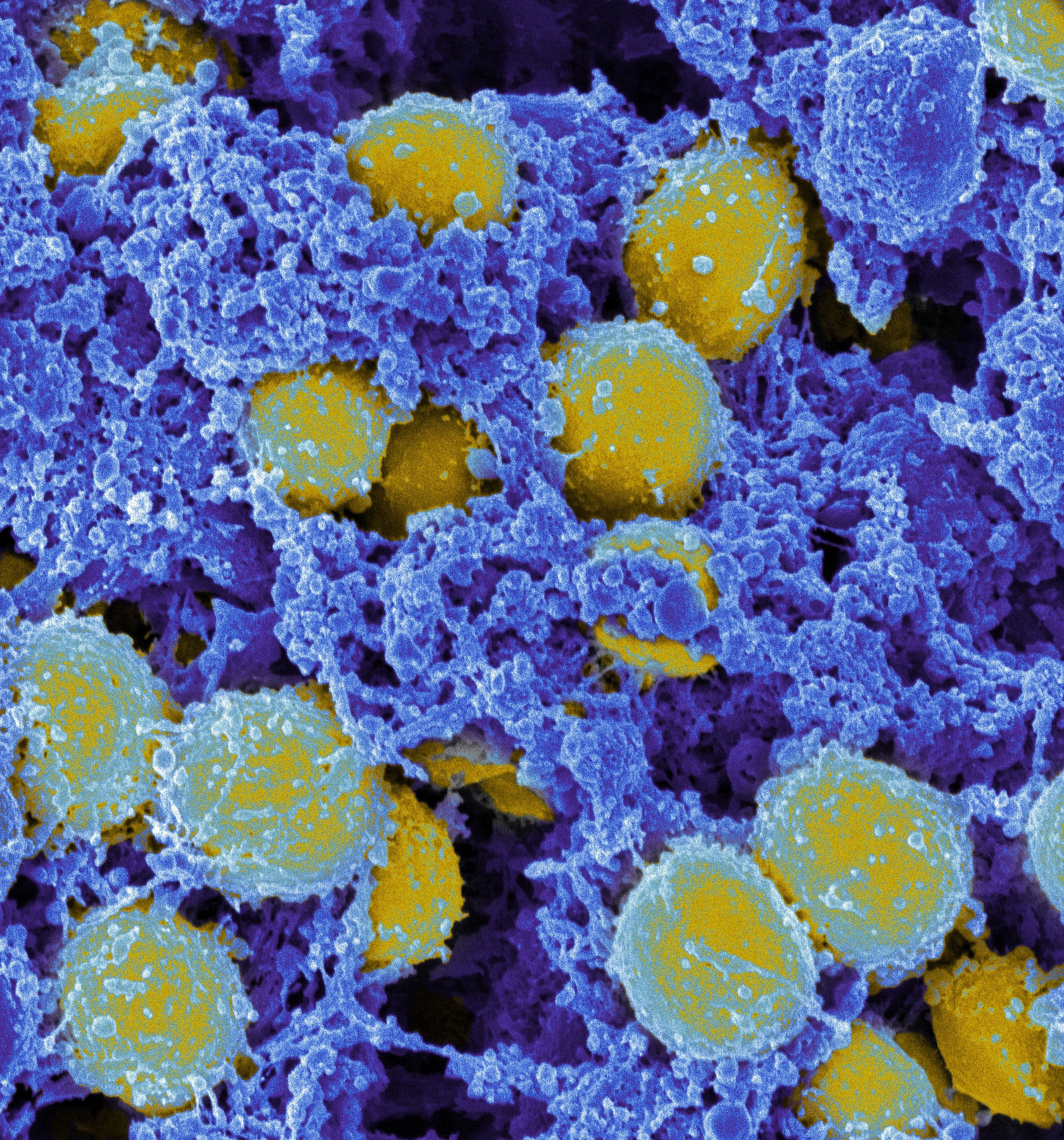 photo of Staphylococcus aureus