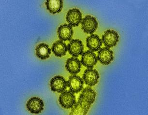 Flu virus particles