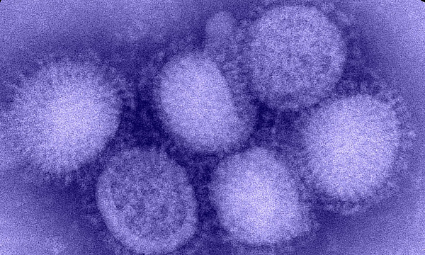 Influenza A virus subtype H1N1