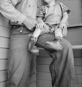 Baby with club feet wearing homemade splints inside shoes. Tulare County, California. Photo by Dorothea Lange, 1939. Prints & Photographs Division