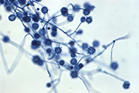 Photo: Exserohilum rostratum