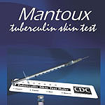 Mantoux Tuberculin Skin Testing Products