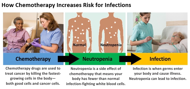 Diagram showing how chemotherapy increases risk for infections. Chemotherapy drugs are used to treat cancer by killing the fastest-growing cells in the body; both good cells and cancer cells. Neutropenia is a side effect of chemotherapy that means your body has fewer than normal infection-fighting white blood cells. Infection is when germs enter your body and cause illness. Neutropenia can lead to infection.
