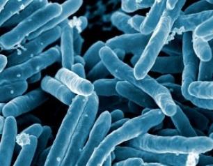 A scanning electron micrograph of Mycobacterium tuberculosis, the bacteria which causes tuberculosis.