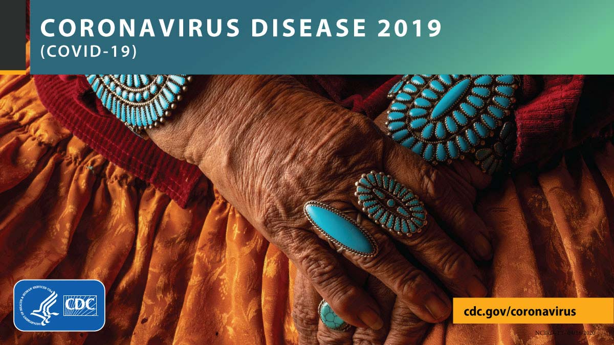 Clasped hands with turquoise jewelry with the text CORONAVIRUS DISEASE 2019 (COVID-19), cdc.gov/covid19, and CDC logo